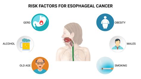esophageal cancer risk factors